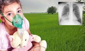 نمونیہ کا مؤثرنباتاتی علاج